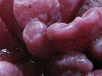 Ascocoryne-sarcoides